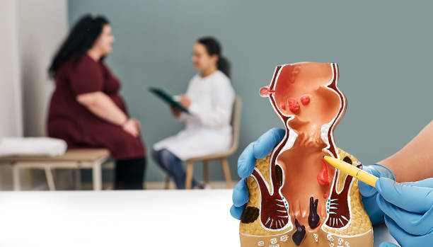 laser proctologist in goregaon